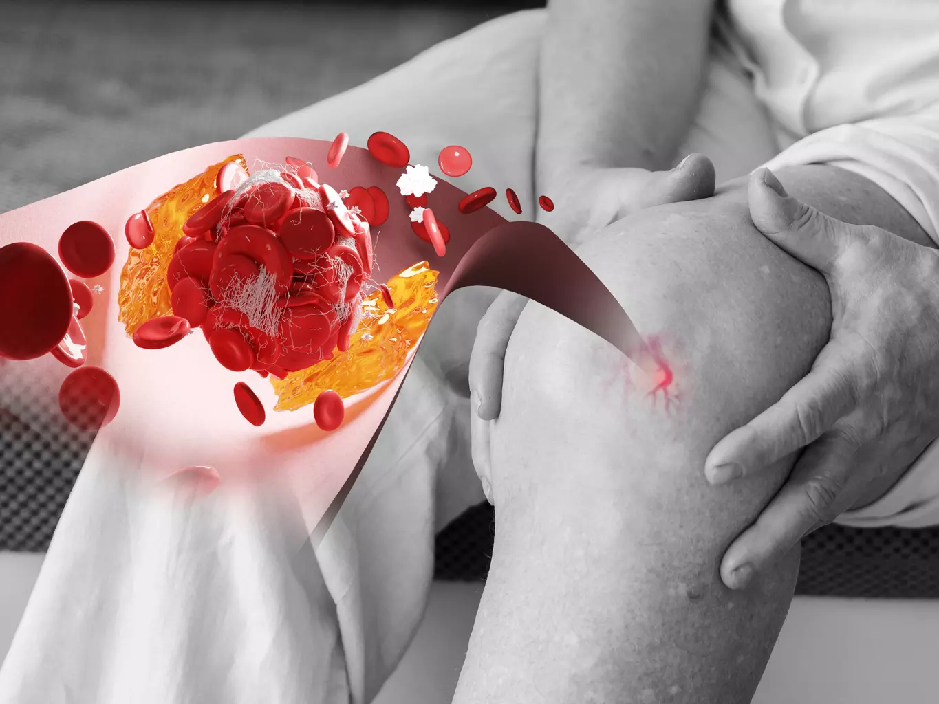 hematopoiesis occurs in which bone marrow