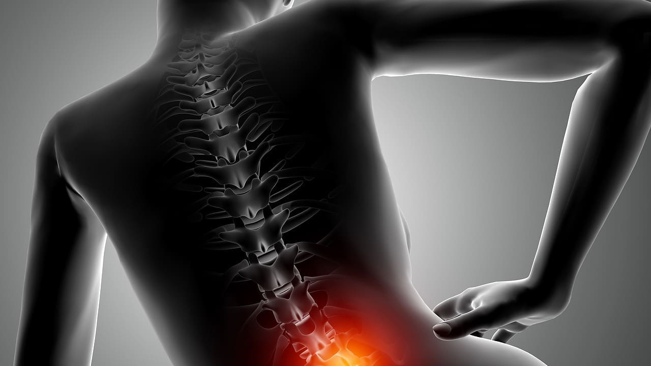 herniated disc sciatica