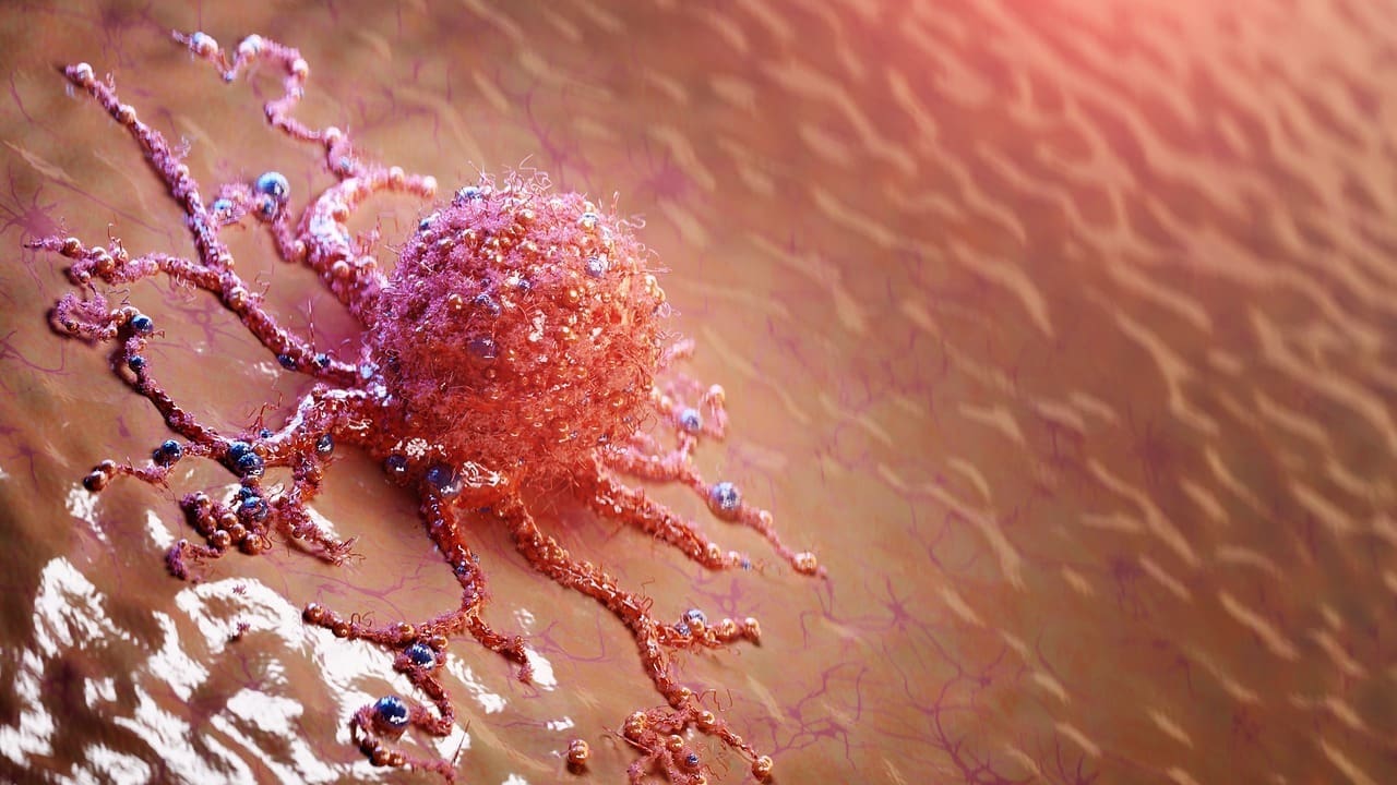 how long can you live with skin cancer