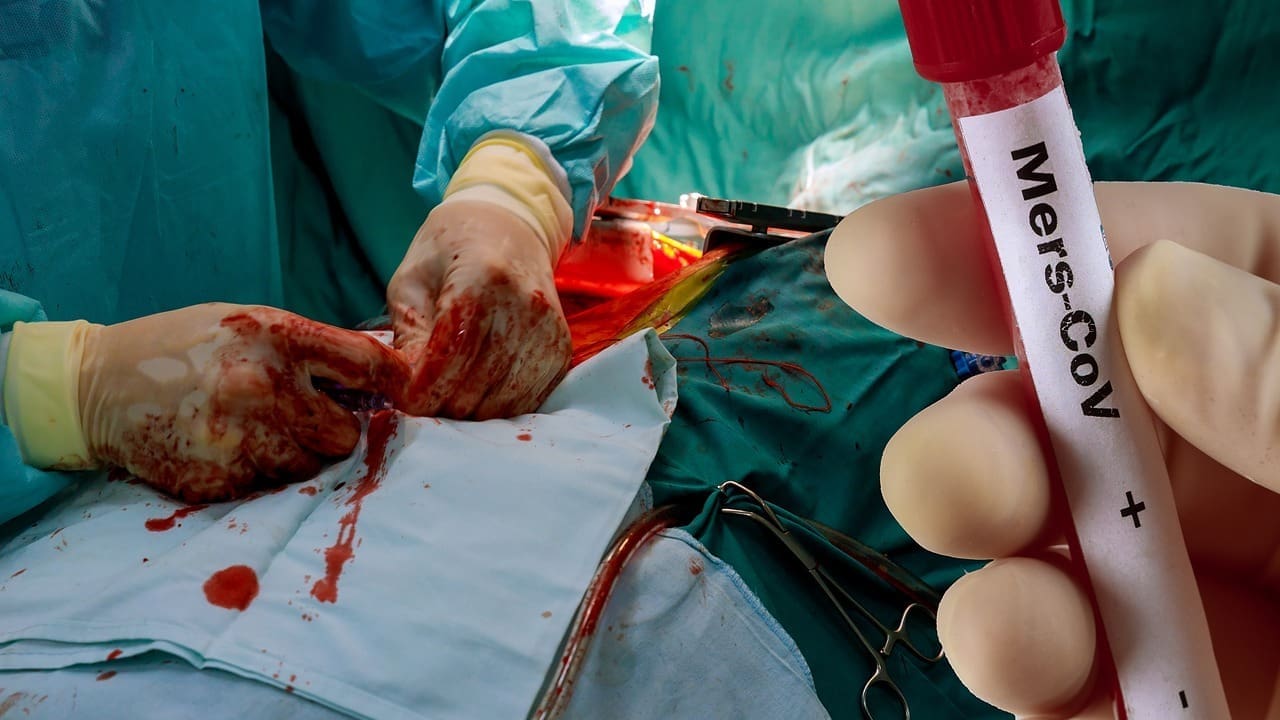 how long do you bleed after green light laser surgery