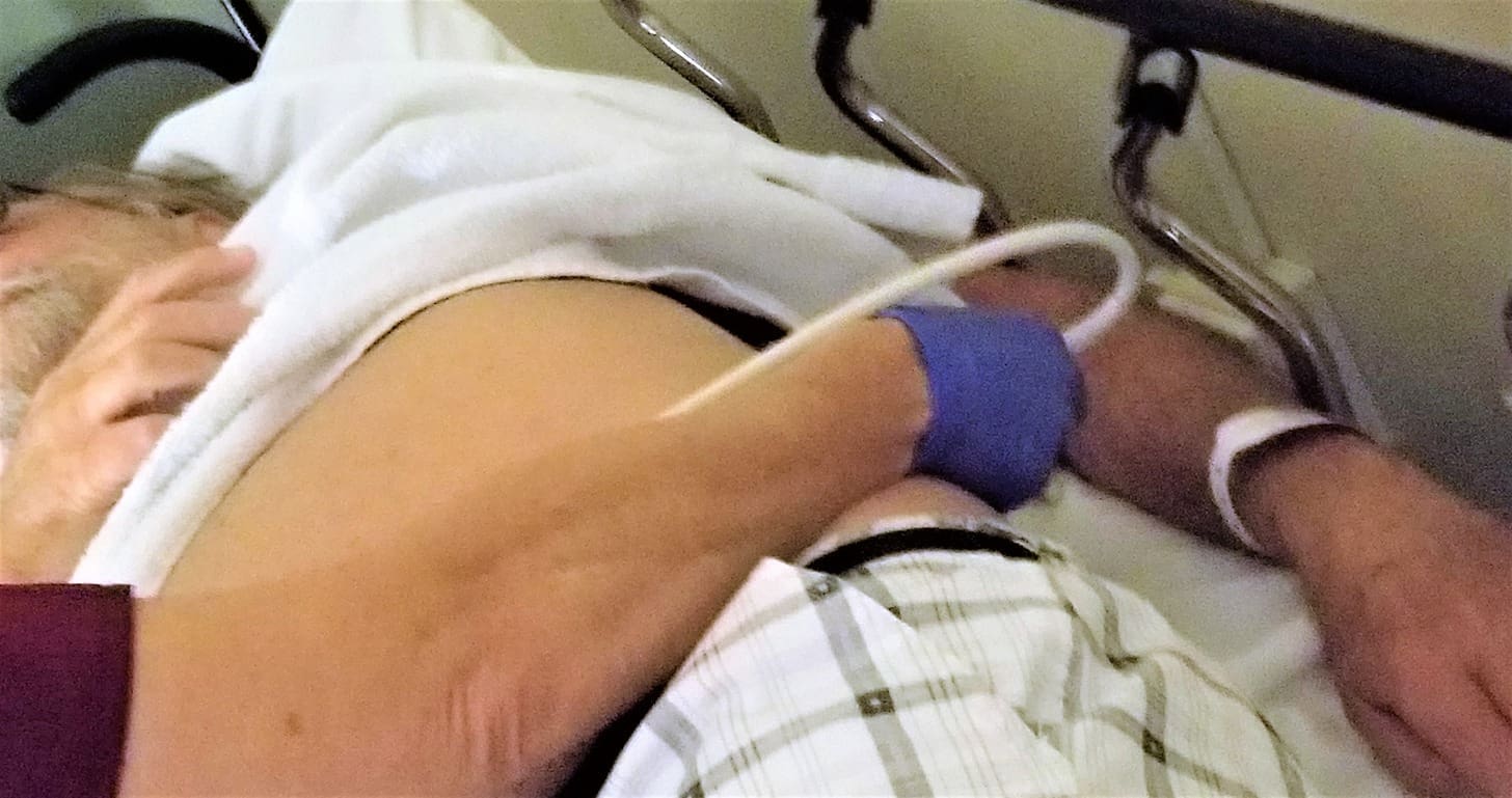 how soon can i exercise after prostate surgery