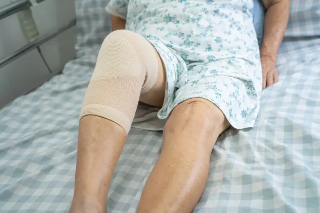 ice after knee replacement