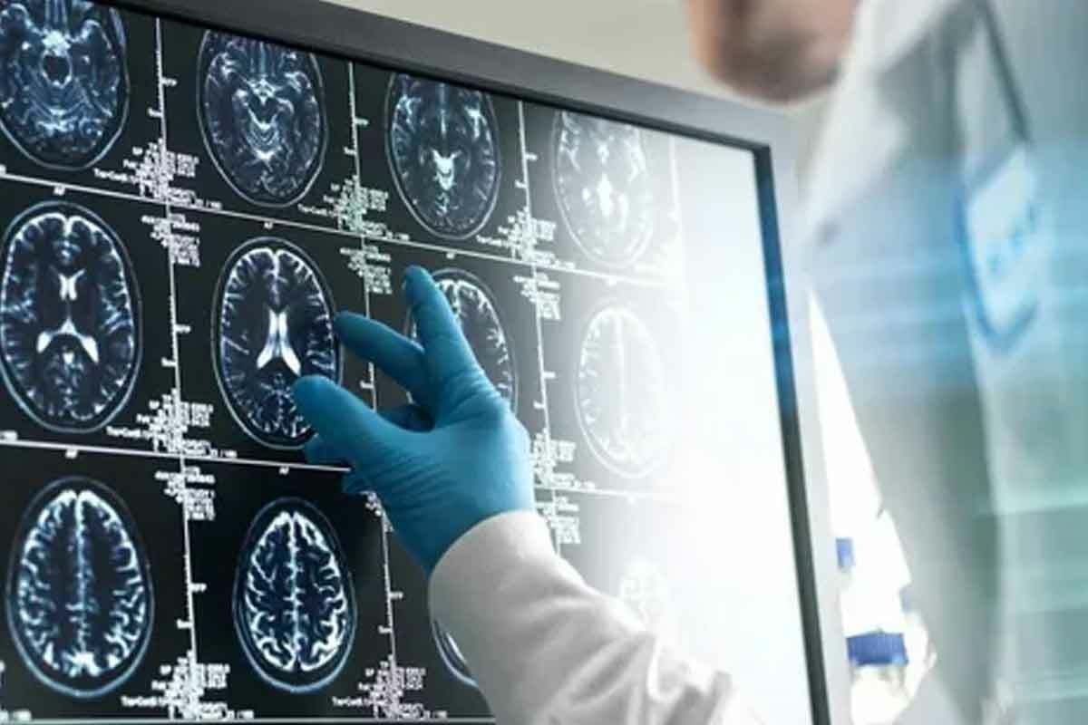 How to Get a Brain Scan: Step-by-Step