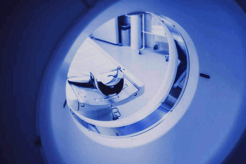 Contrast Dye Sensation: Why It Feels Like You’re Peeing