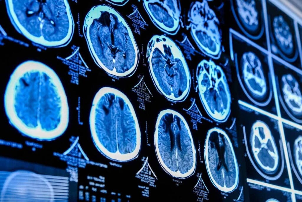 PET Scan History: 7 Key Milestones Explained