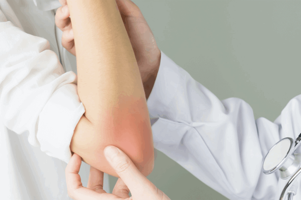 Most Effective Psoriatic Arthritis Treatment Options
