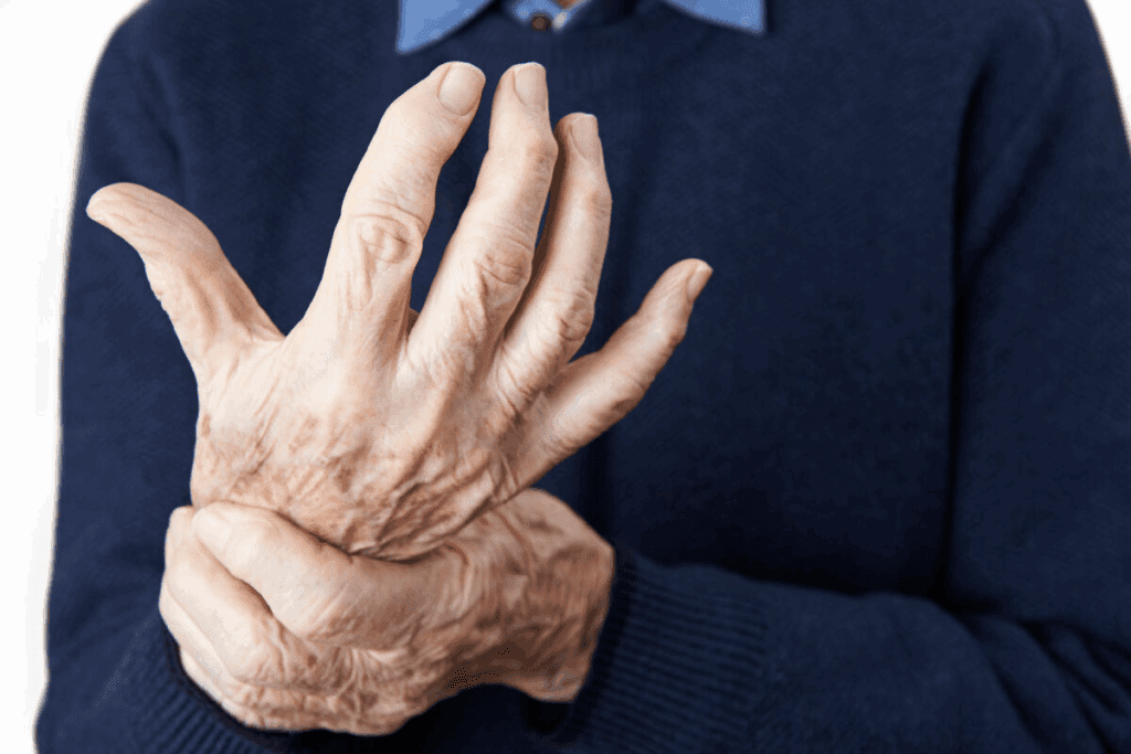The Connection Between COVID Psoriatic Arthritis