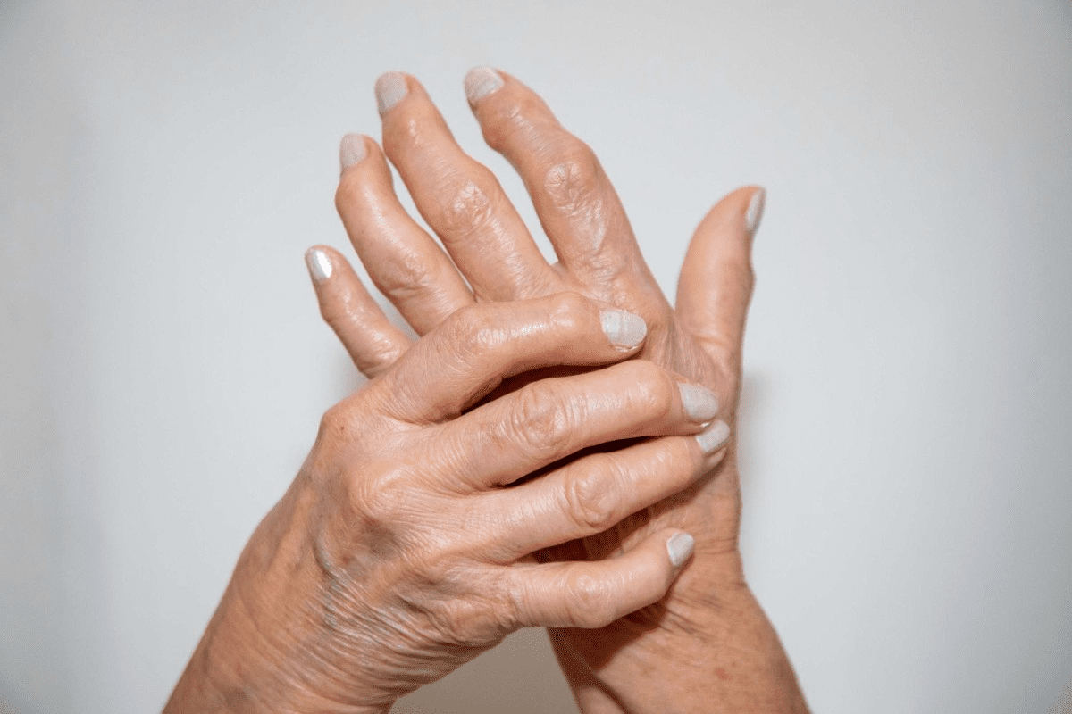 Tips for Living with Psoriatic Arthritis Successfully