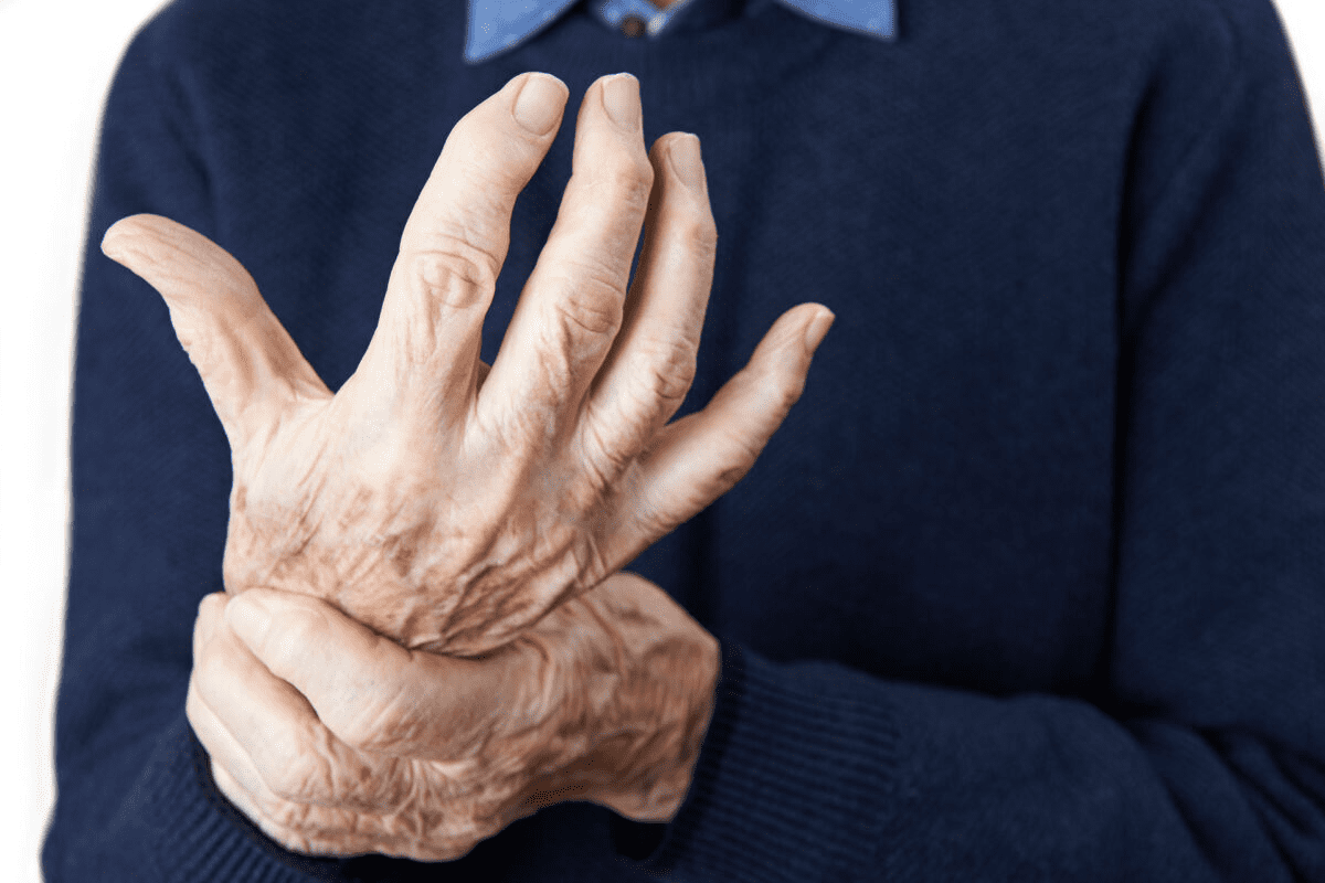 5 Cancers Linked Psoriatic Arthritis: Risks Explained