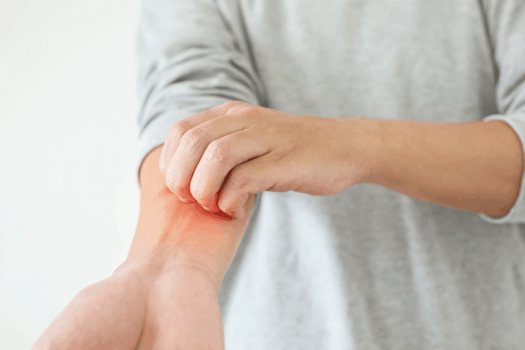 Arthritis and Psoriatic Arthritis: Can It Lead to Disability?