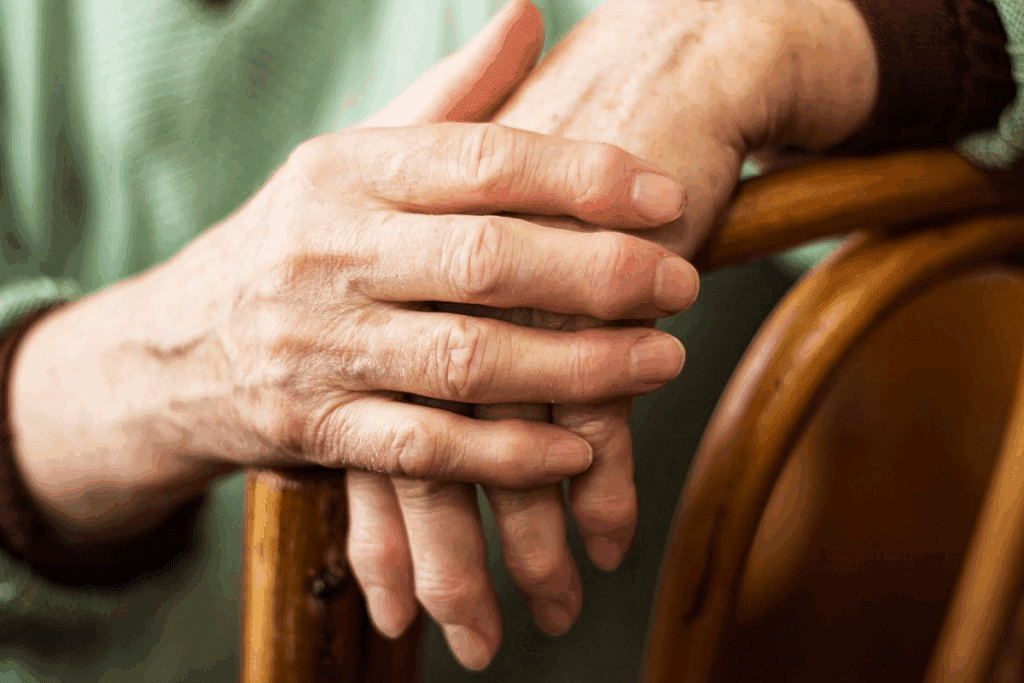 Early Signs of Psoriatic Arthritis and Common Age Range