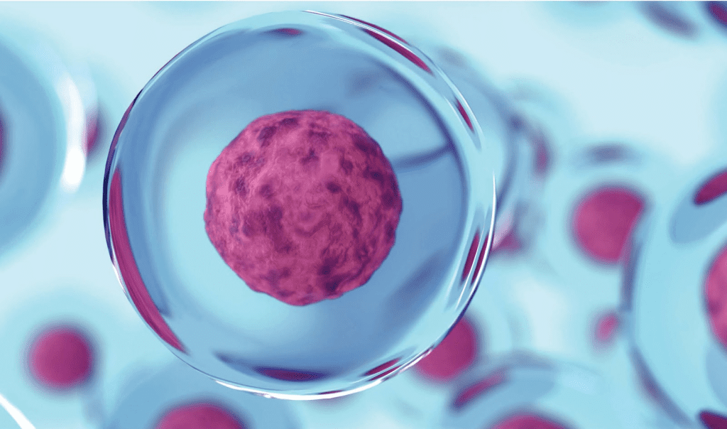 Leukemia Symptoms in Kids: Crucial CBC Look 3 Leukemia Symptoms in Kids: Crucial CBC Look