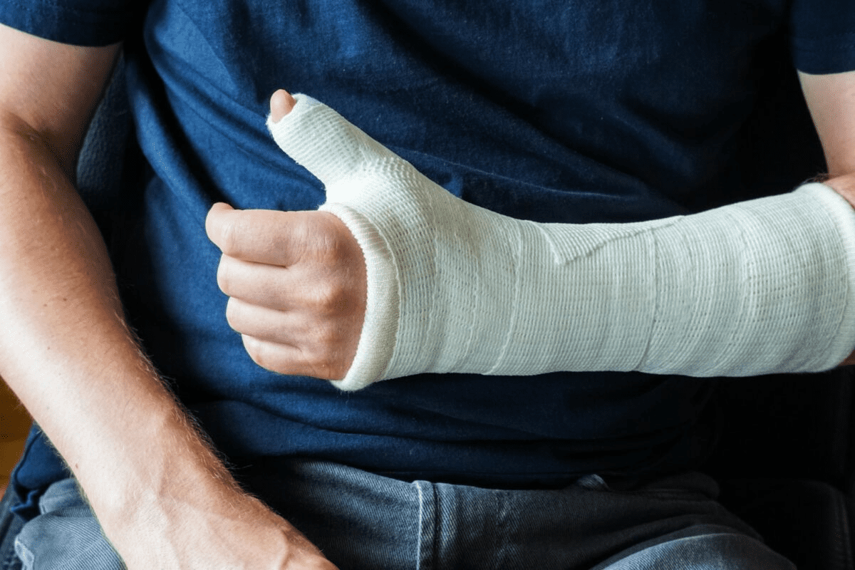 Fracture Healing Time: Your Essential timeline to Faster recovery
