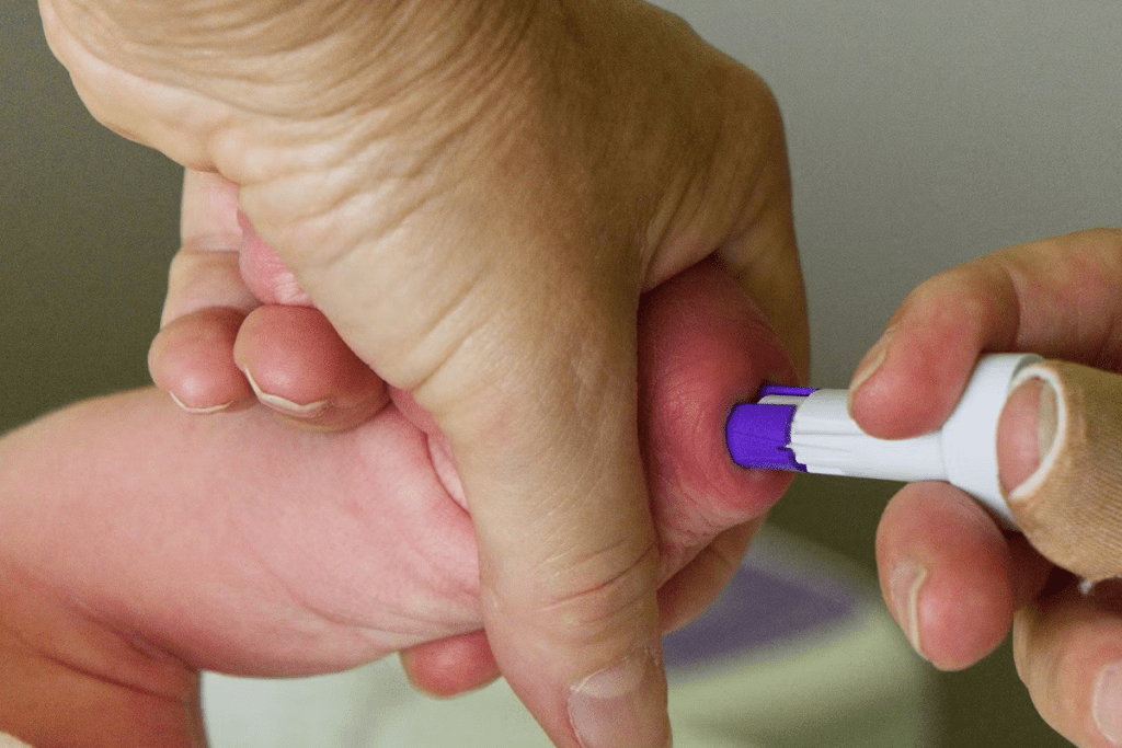 Blood Transfusion for Anemia: Pediatric Guidelines