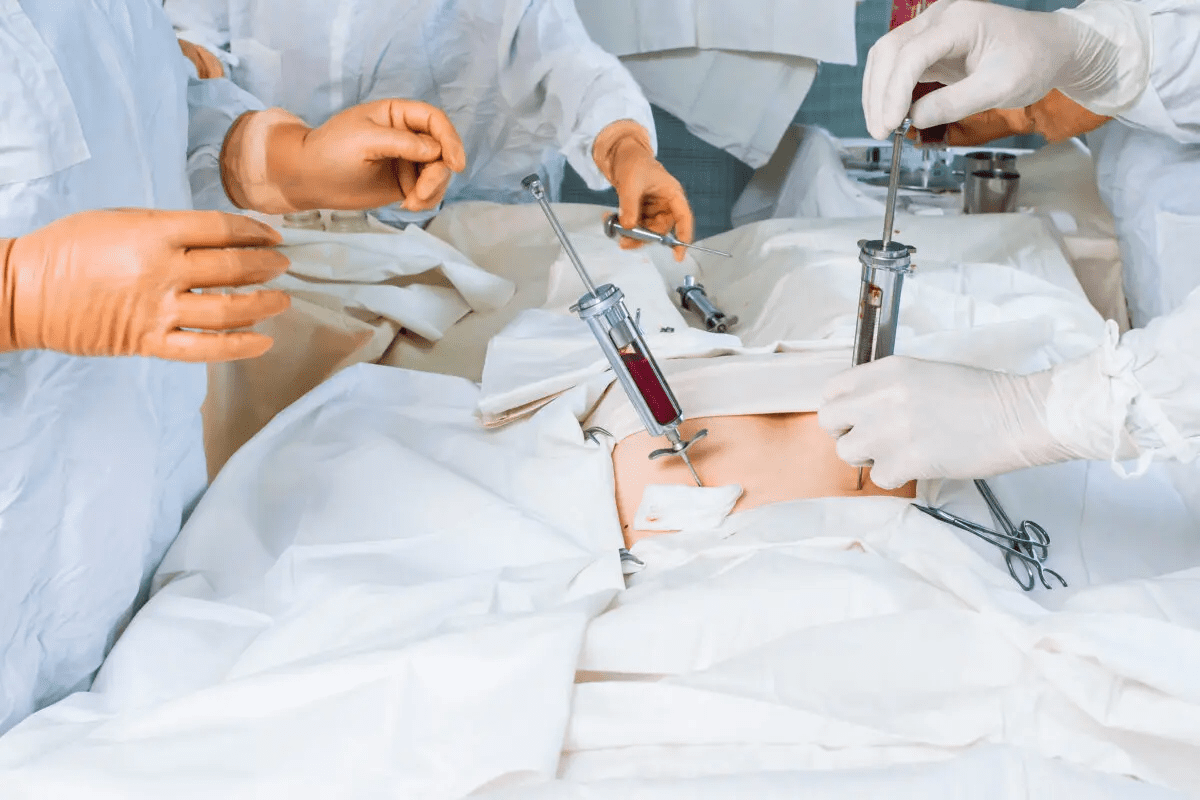 7 Key Facts About Bone Marrow Transplant for Multiple Myeloma