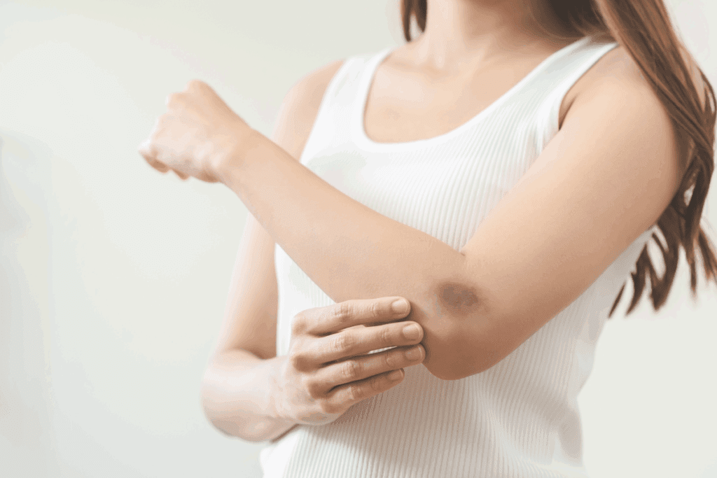 What is the Best Medicine for Broken Bones?