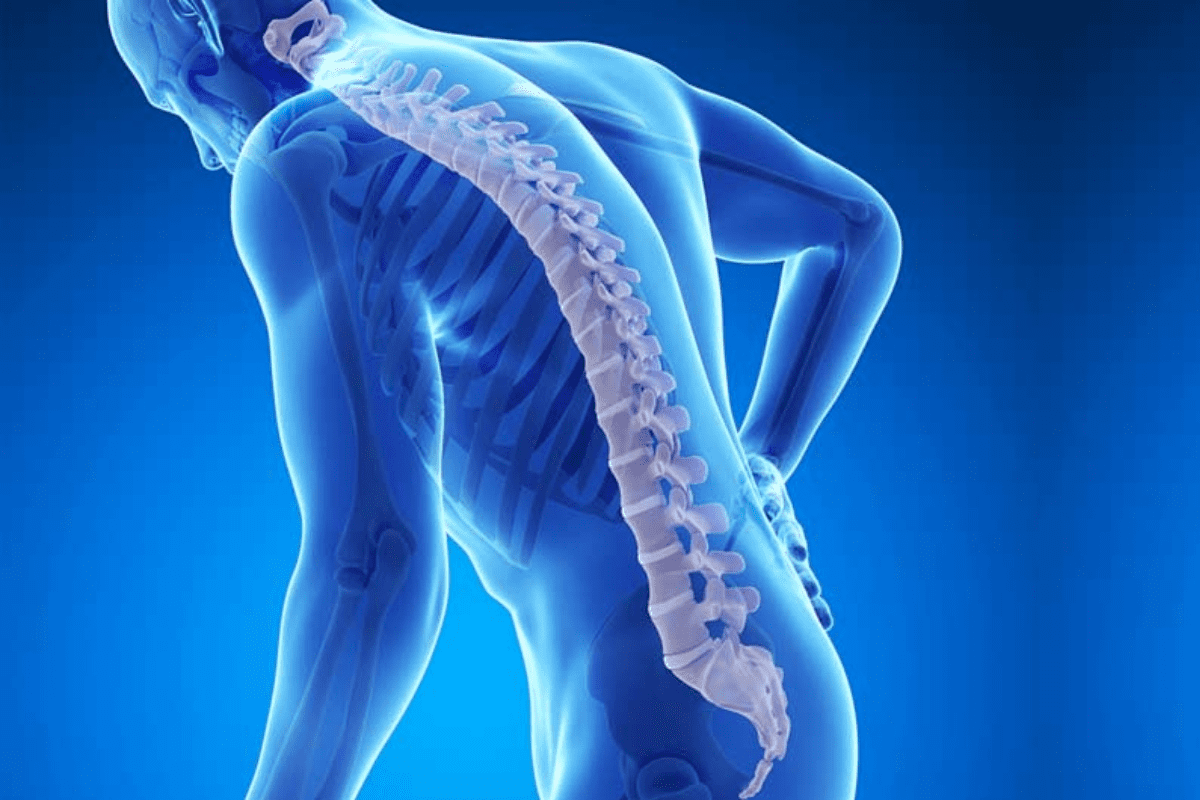 Osteoporosis Primary Cause Explained