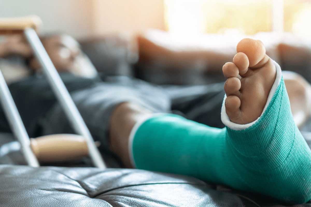 Bone Fracture Severity: How Serious Is It?