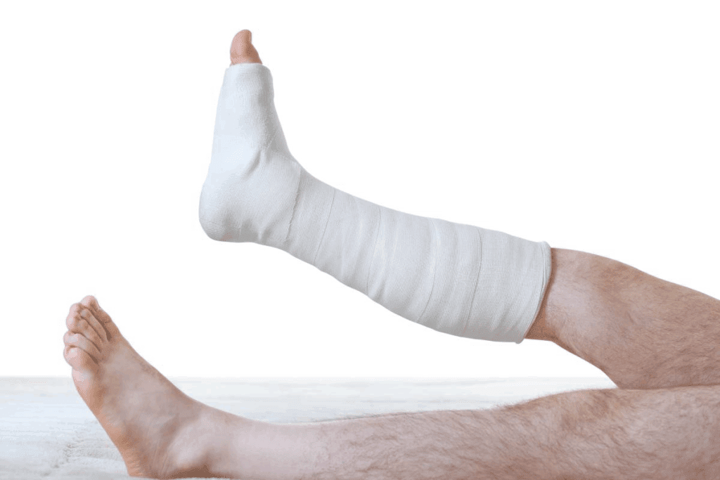 Fracture Treatment Methods and Options