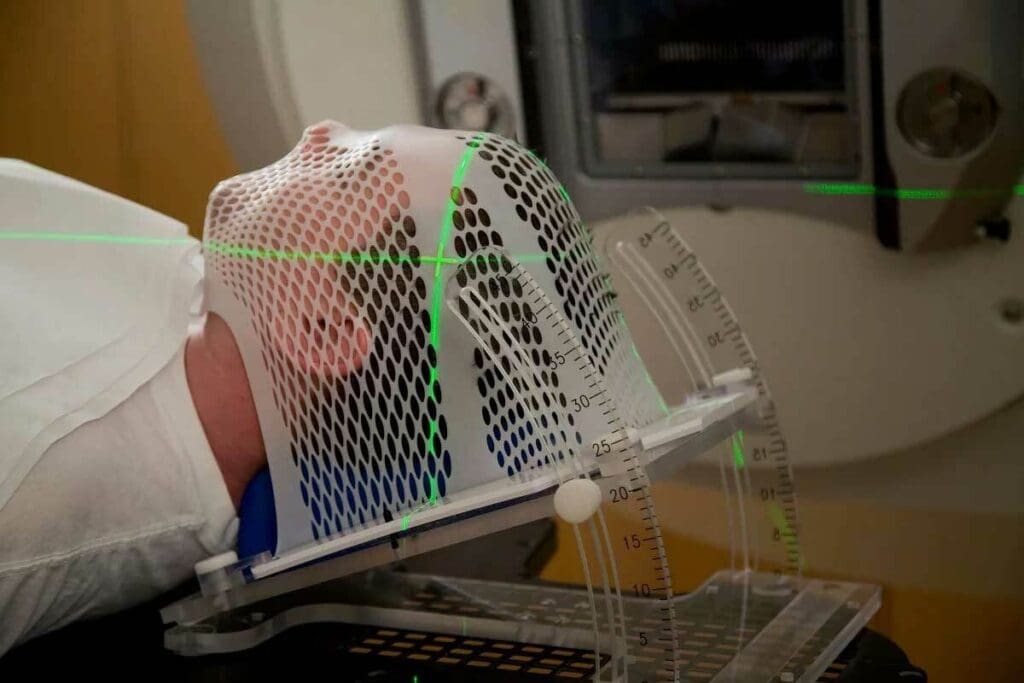 What is the Maximum Number of Radiation Treatments?