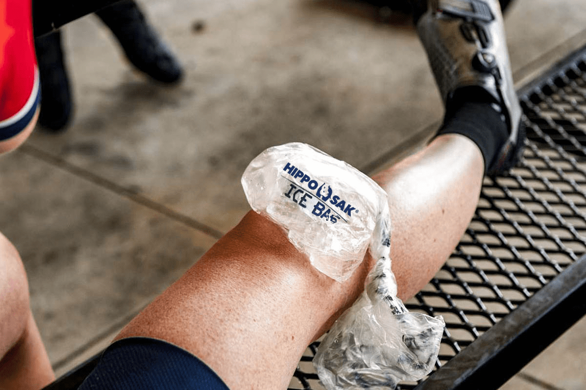 Icing a Broken Bone: How Many Days Needed