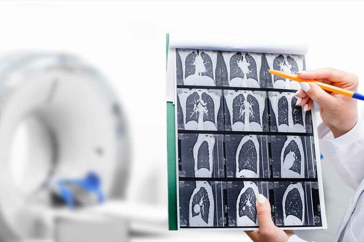 How Long for CT Results? Cancer Detection Guide