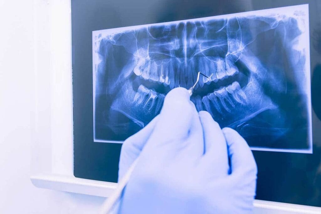 How Many X Rays Are Safe In A Month? The Best Guide