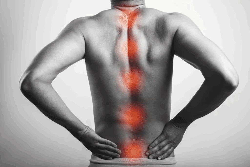 Common Conditions Mistaken for Herniated Disc Pain