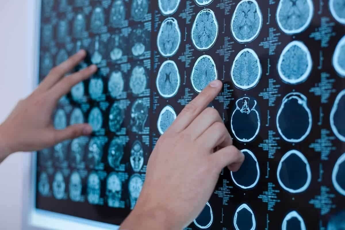 How Do You Treat Brain Cancer? Effective Options