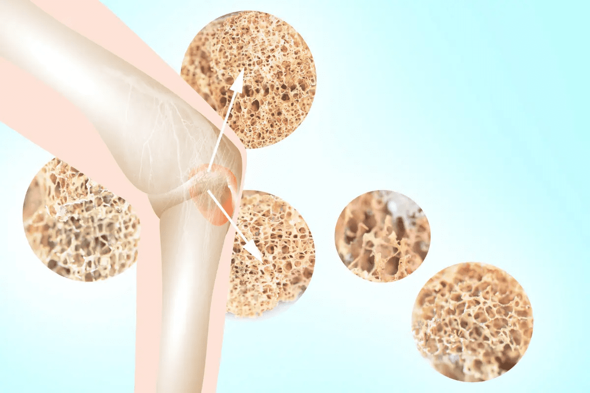 Problems with Bone Marrow Symptoms: 10 Common Signs