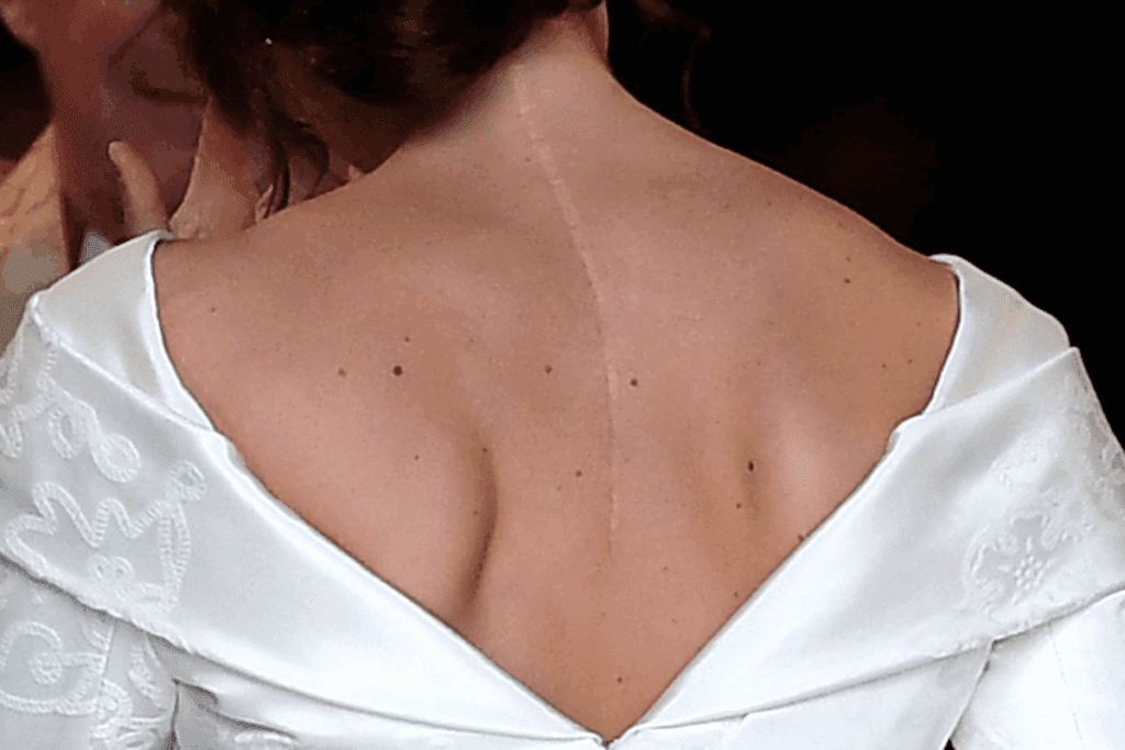 The Newest Spinal Treatment for Stenosis Relief