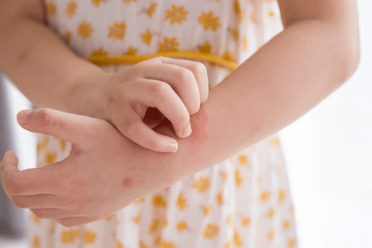8 Key Signs Of Anemia In Children: Spot Symptoms Early