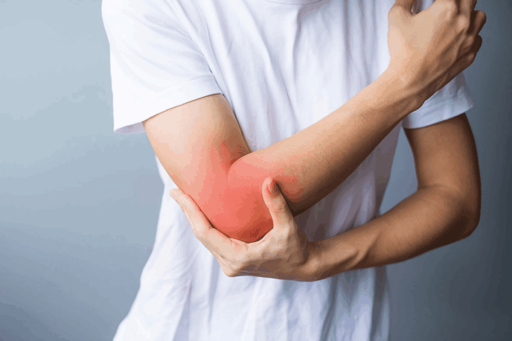 Long-Term Trochanteric Bursitis Prognosis and Recovery 3 Long-Term Trochanteric Bursitis Prognosis and Recovery