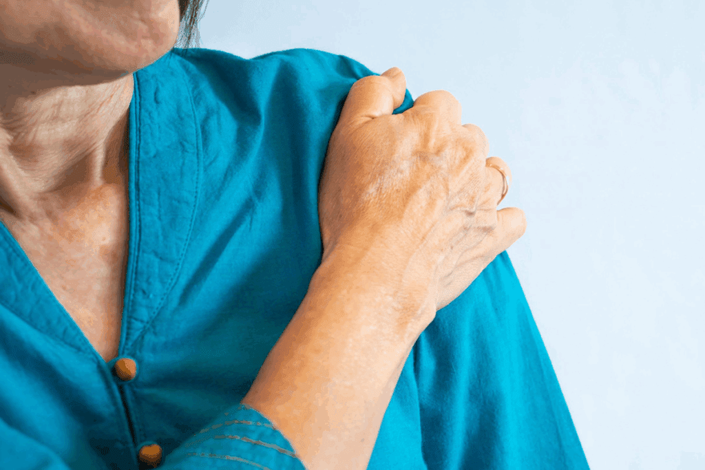 Best Supplements for Bursitis Relief and Recovery