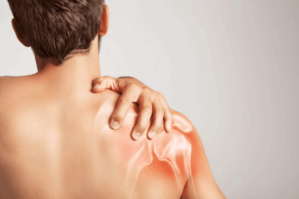 When Do You Need Surgery for Impinged Shoulder