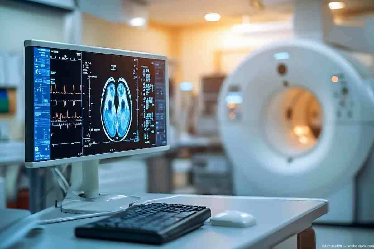 Do CT Scans Cause Cancer? The Ultimate Shocking Truth
