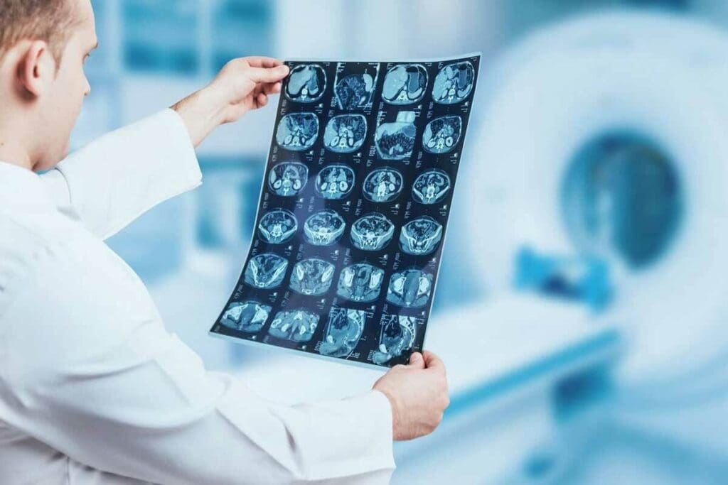 How Many CT Scans Not Been Seen by Radiologists? 2 How Many CT Scans Not Been Seen by Radiologists?