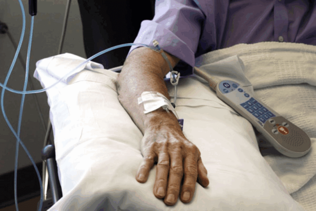 how to diagnose polycythemia – Blood Tests & Steps