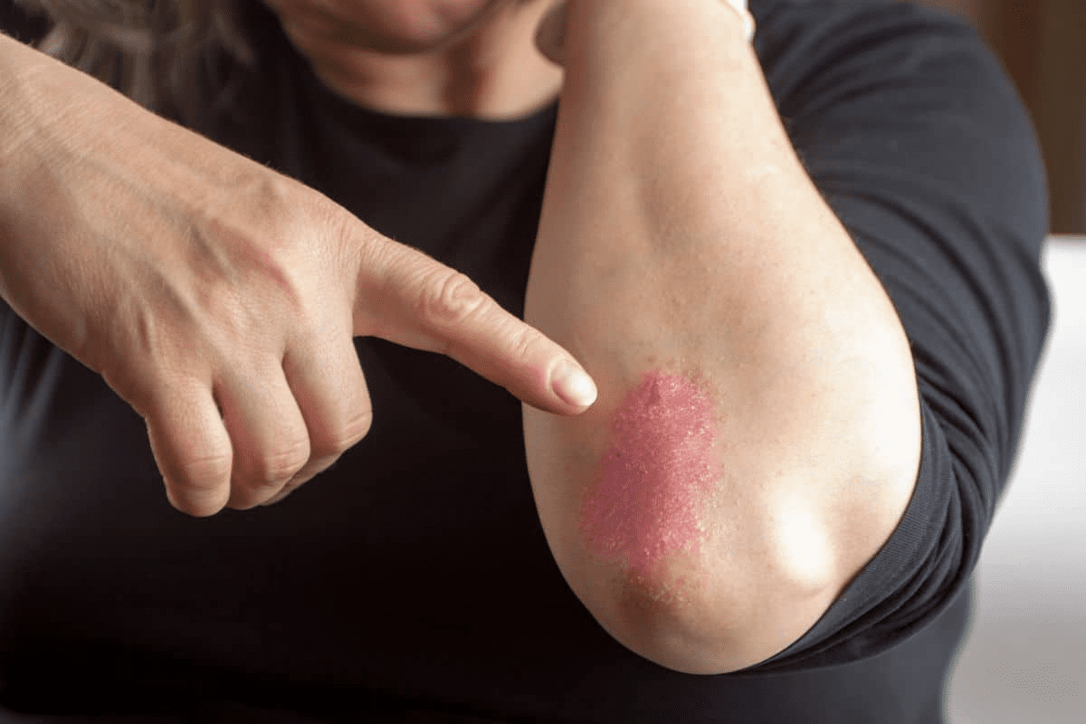 Blood Disease Symptoms Skin: 12 Early Signs