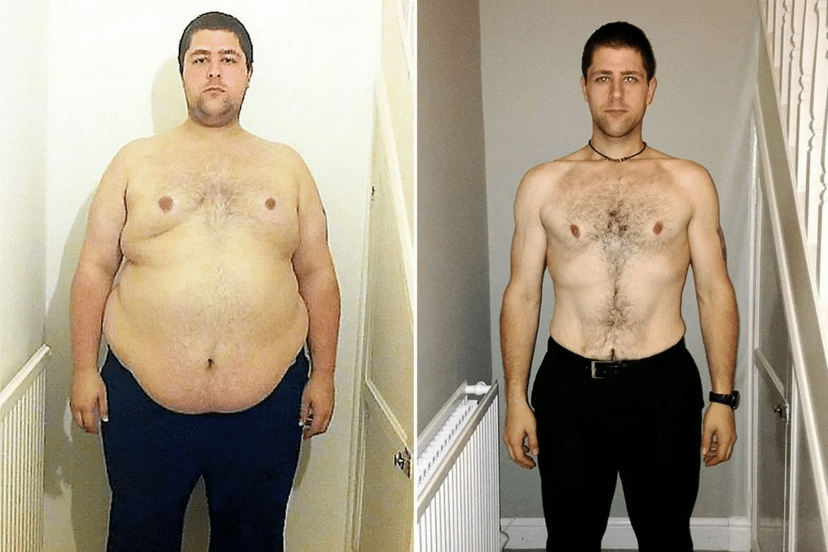 Chemotherapy After Surgery: What to Know