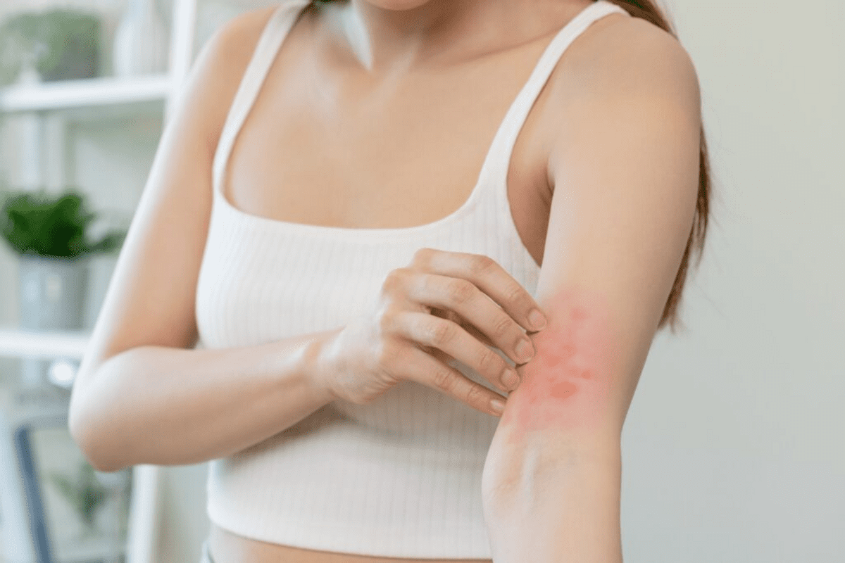 Itchy Skin Rash and Bruising: 7 Causes