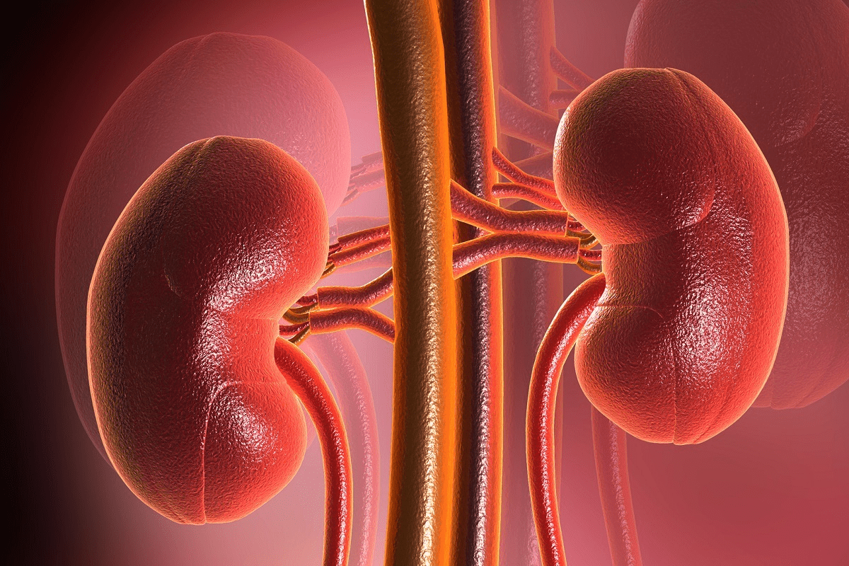 Cryoablation Renal Mass: 7 Key Facts You Need to Know