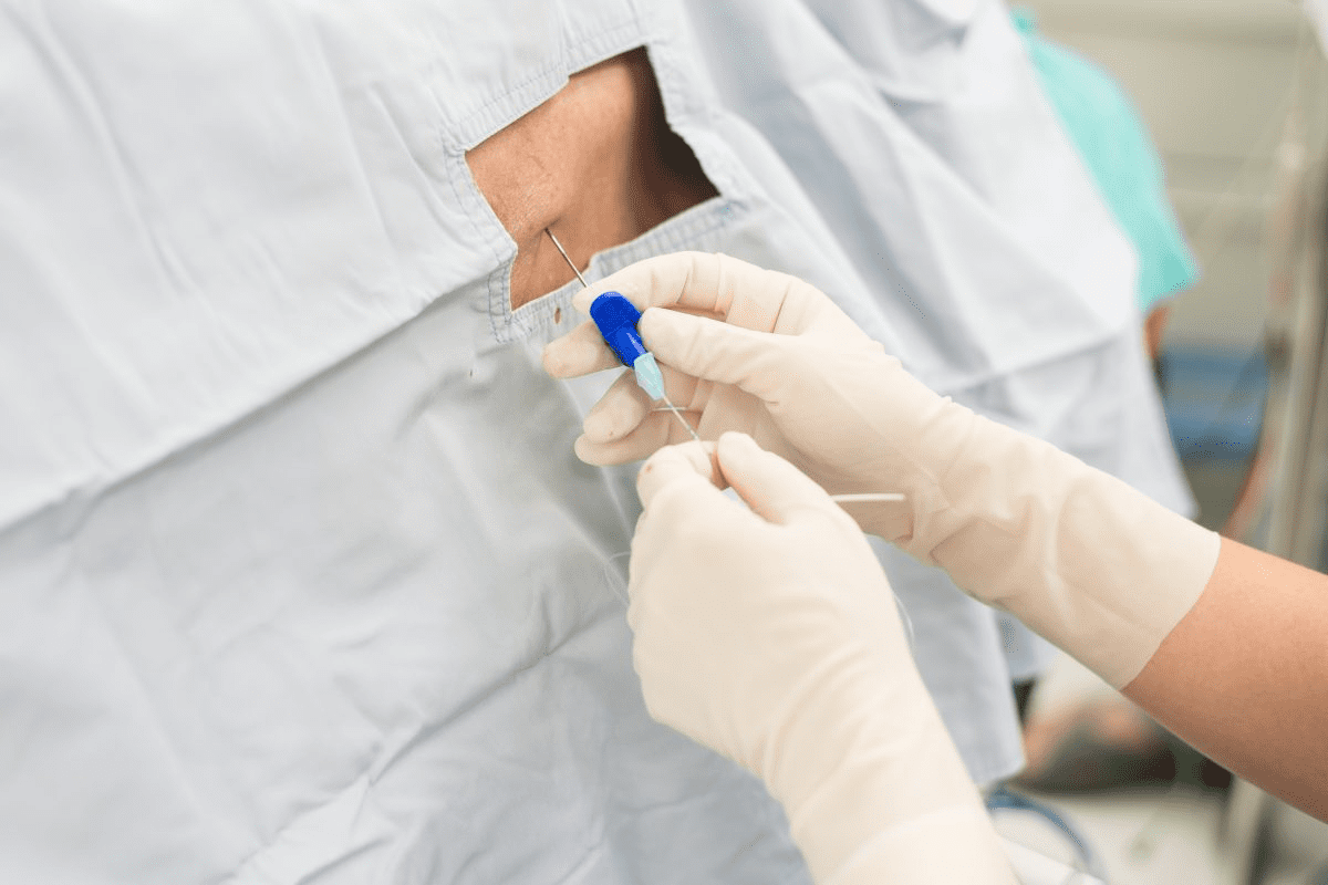 How Long Do Epidurals Last? Duration Explained