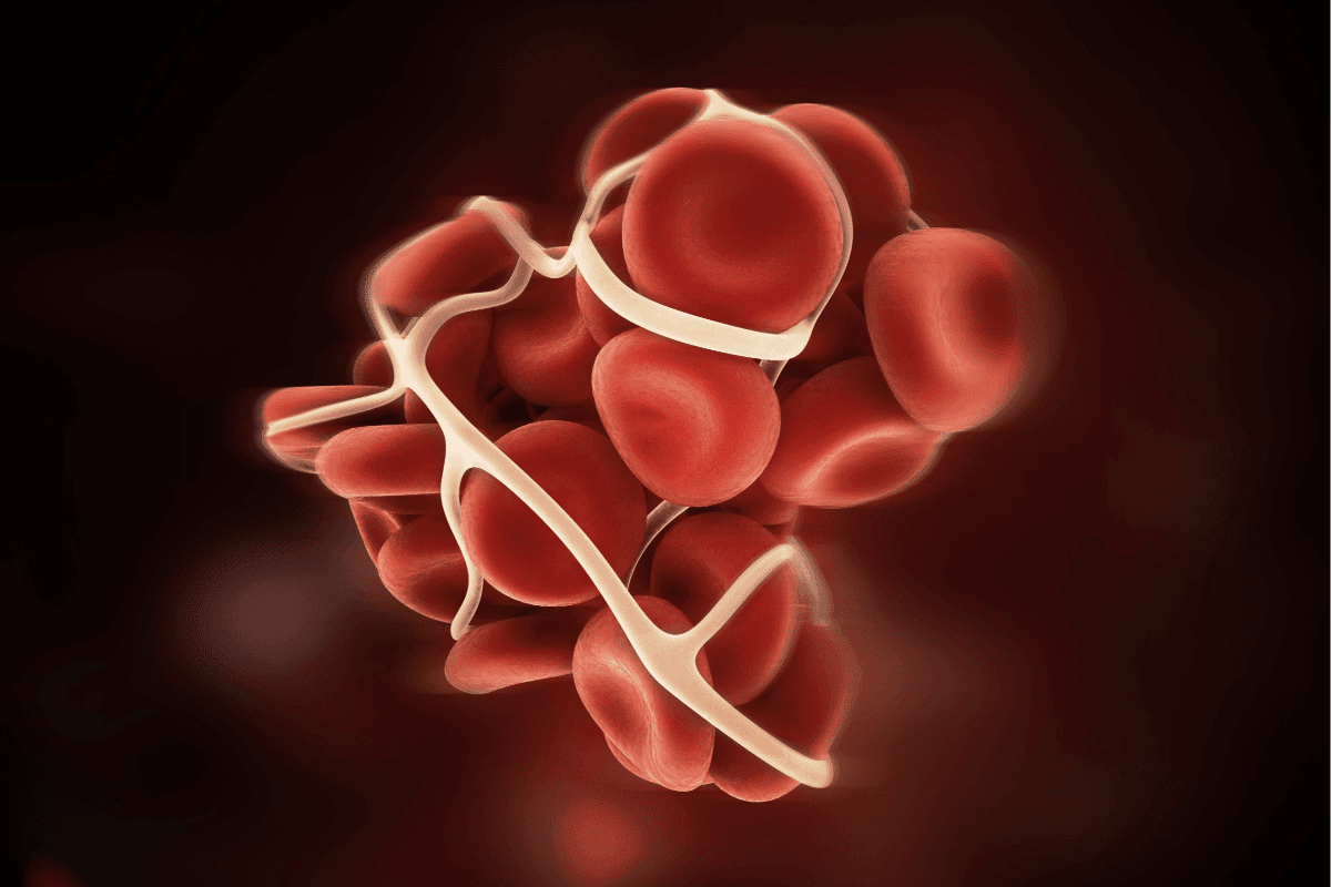 10 Key Blood Clot Medical Terms: Definitions & Quick Reference Guide