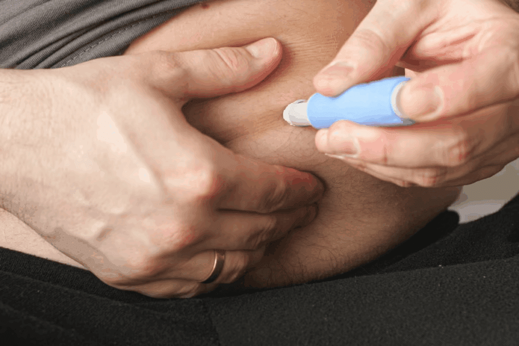 Epidural Injection Video: Step-by-Step Guide