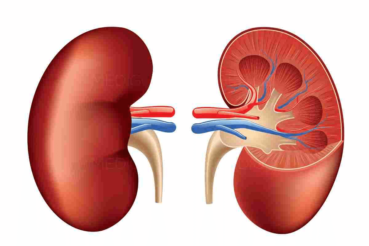 Lithotripsy: Negative Impact on Your Kidneys