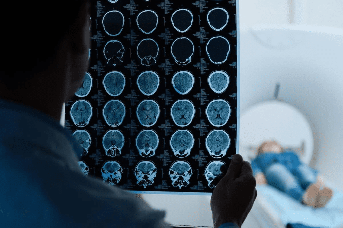 How to Perform a coil embolization procedure for Brain Aneurysm Treatment