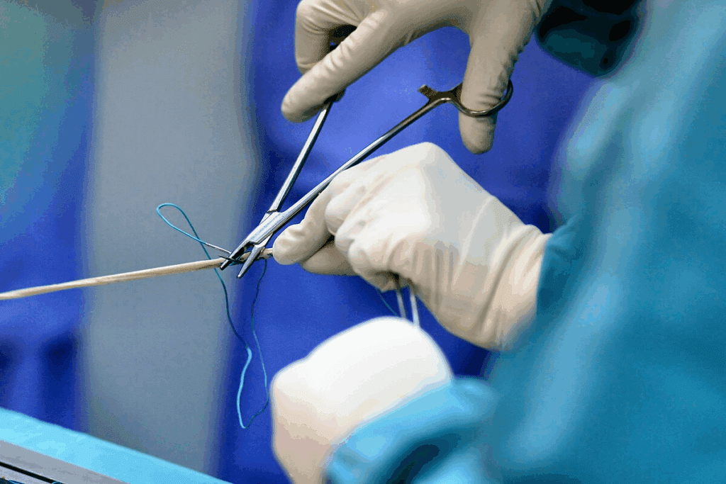 Bile Duct Stent Procedure: Step-by-Step ERCP Guide
