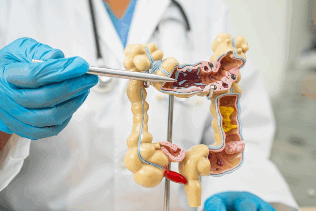 Colon Resection Complications: 12 Alarming Problems