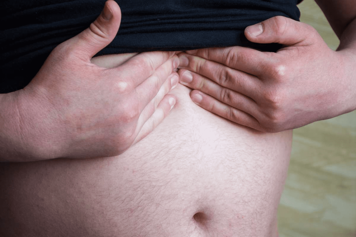 Sternum Hernia: 7 Critical Dangers & Causes
